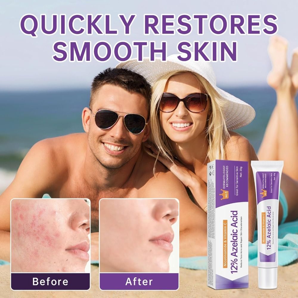 Azelaïnezuur 12% 20% Serum Aze - Azelaic Acid Serum recensie en prijs