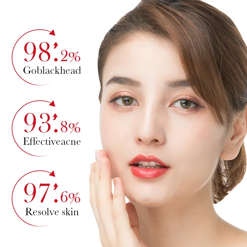 BIOAQUA Salicylzuur Acne Verwi - Azelaic Acid Serum recensie en prijs