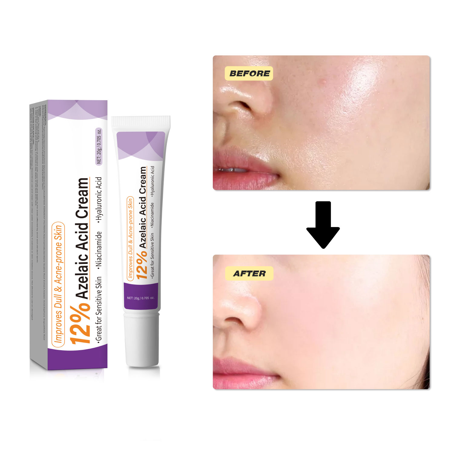 Milde Azelaïnezuurcrème verbet - Azelaic Acid Serum recensie en prijs